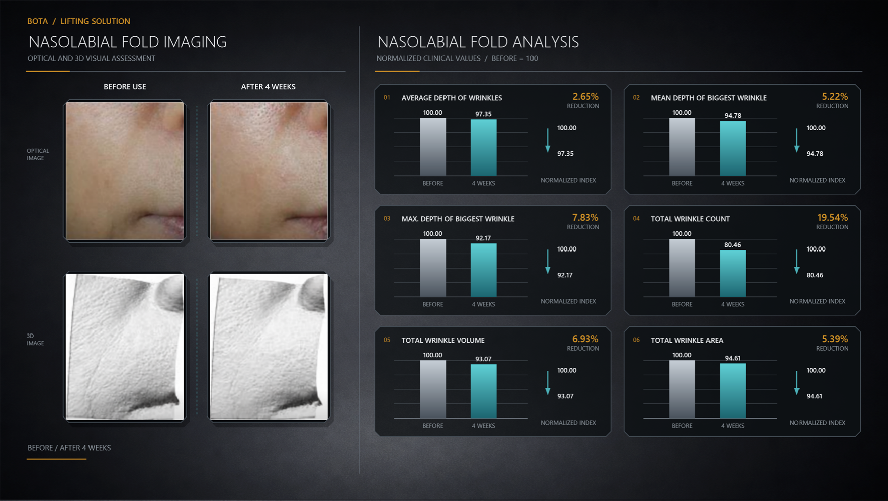 NEXCELL BOTA evaluation with baseline and four-week nasolabial optical and 3D images and six reported wrinkle metrics