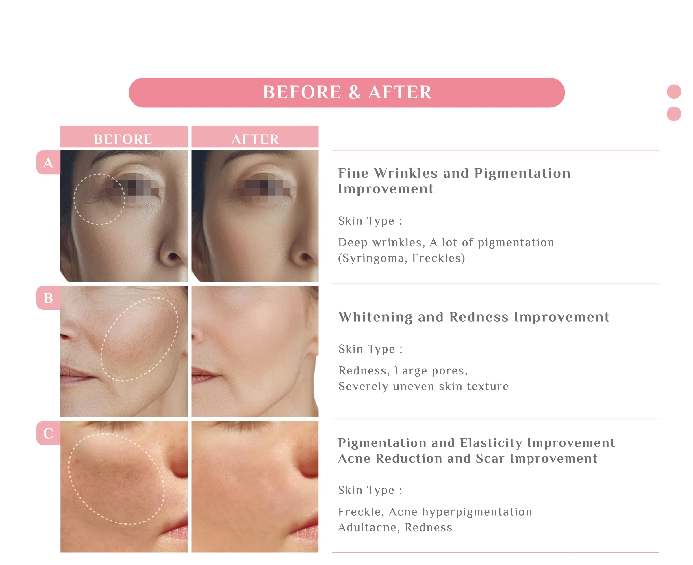 PiNkLLA · product information