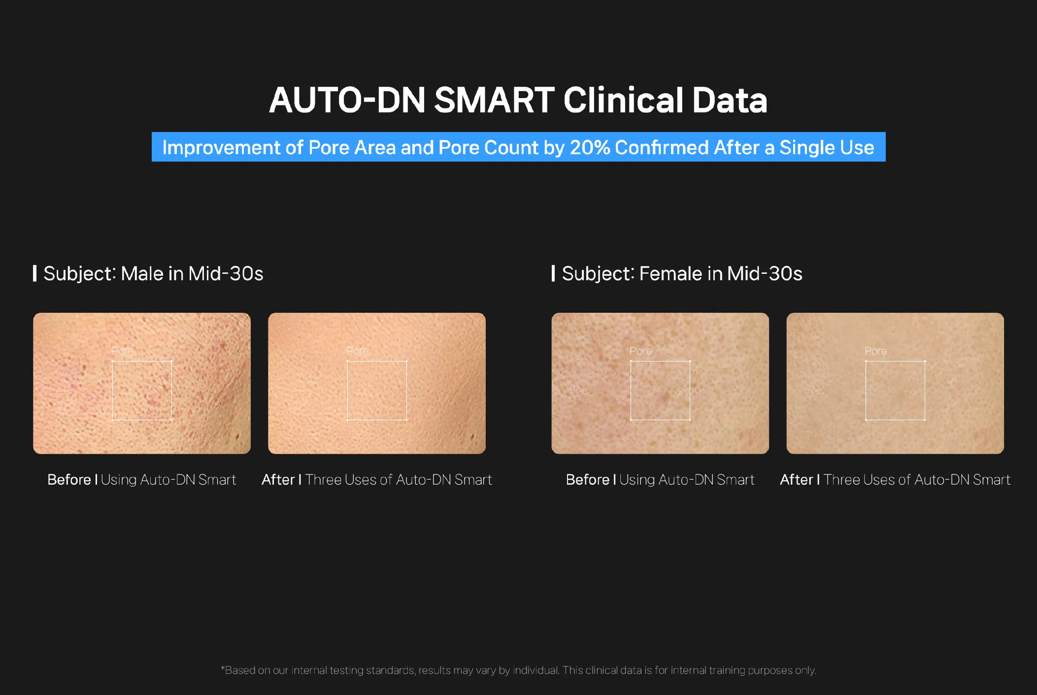 Auto-DN Smart · product information