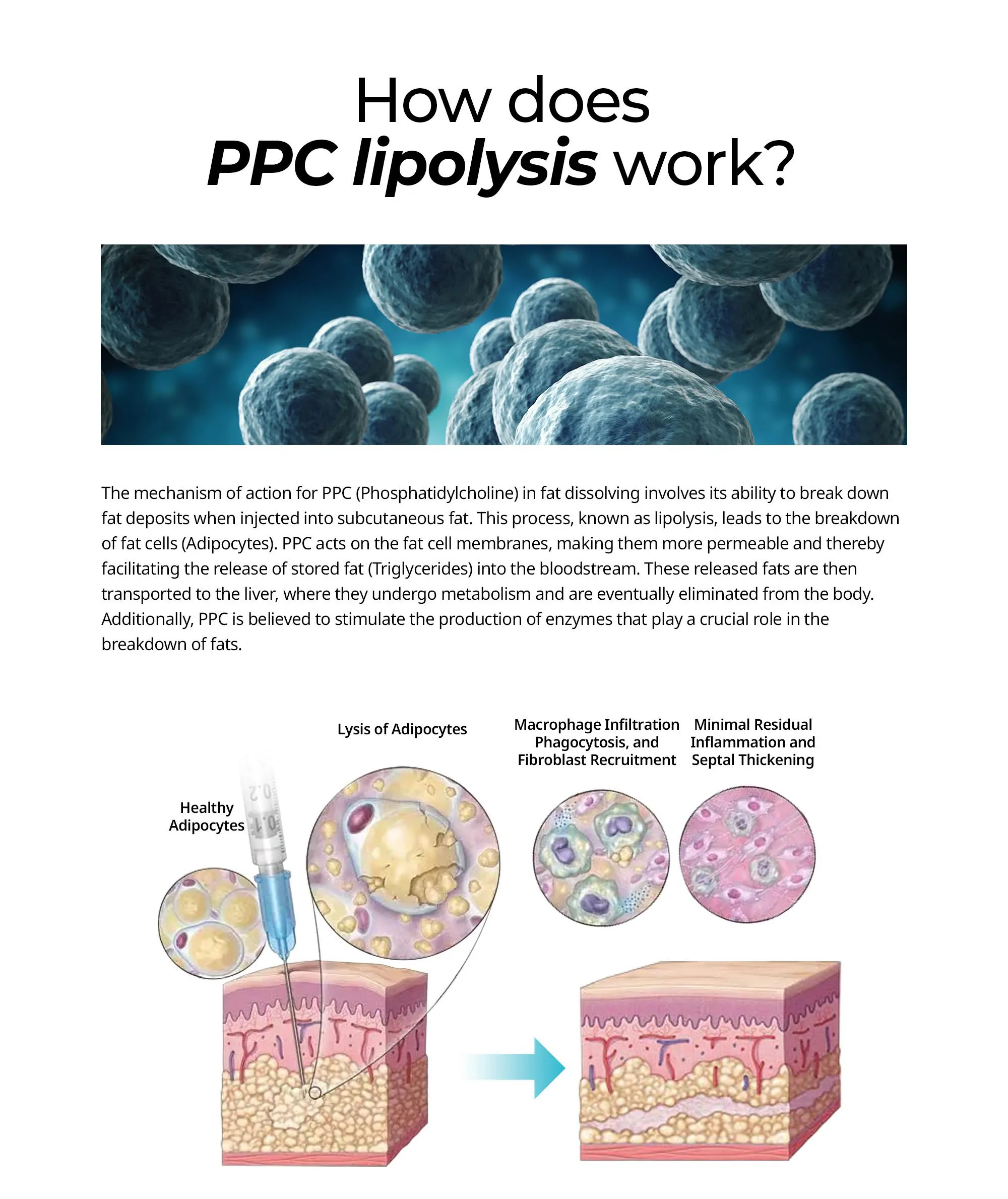 Dr. Lipo+ PPC solution (Body) · product information