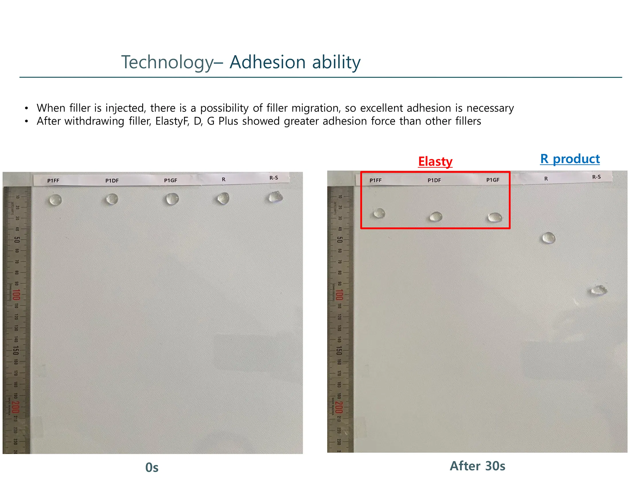 Elasty G Plus (2 syringes) · product information