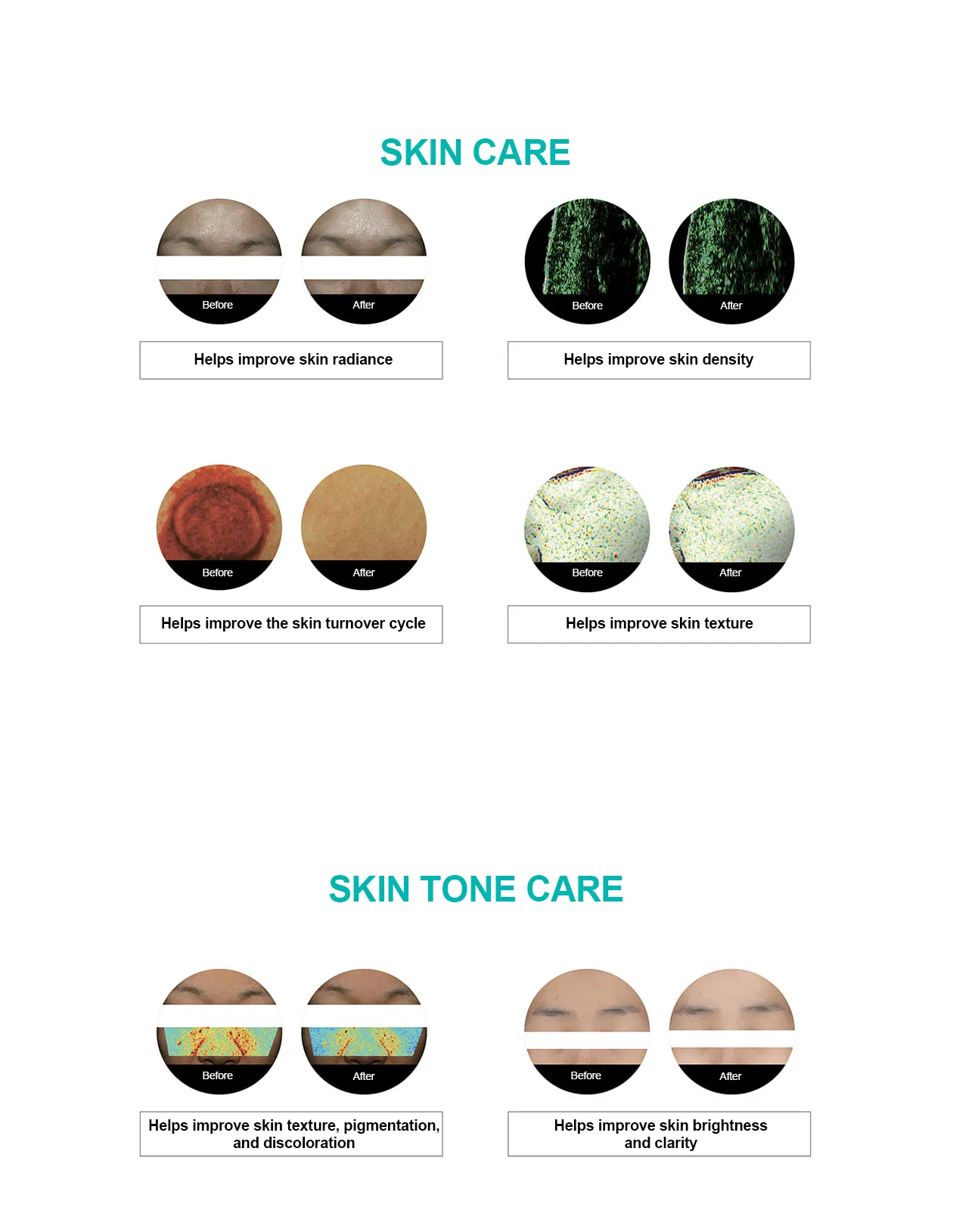 Rejuran Turnover Ampoule · product information