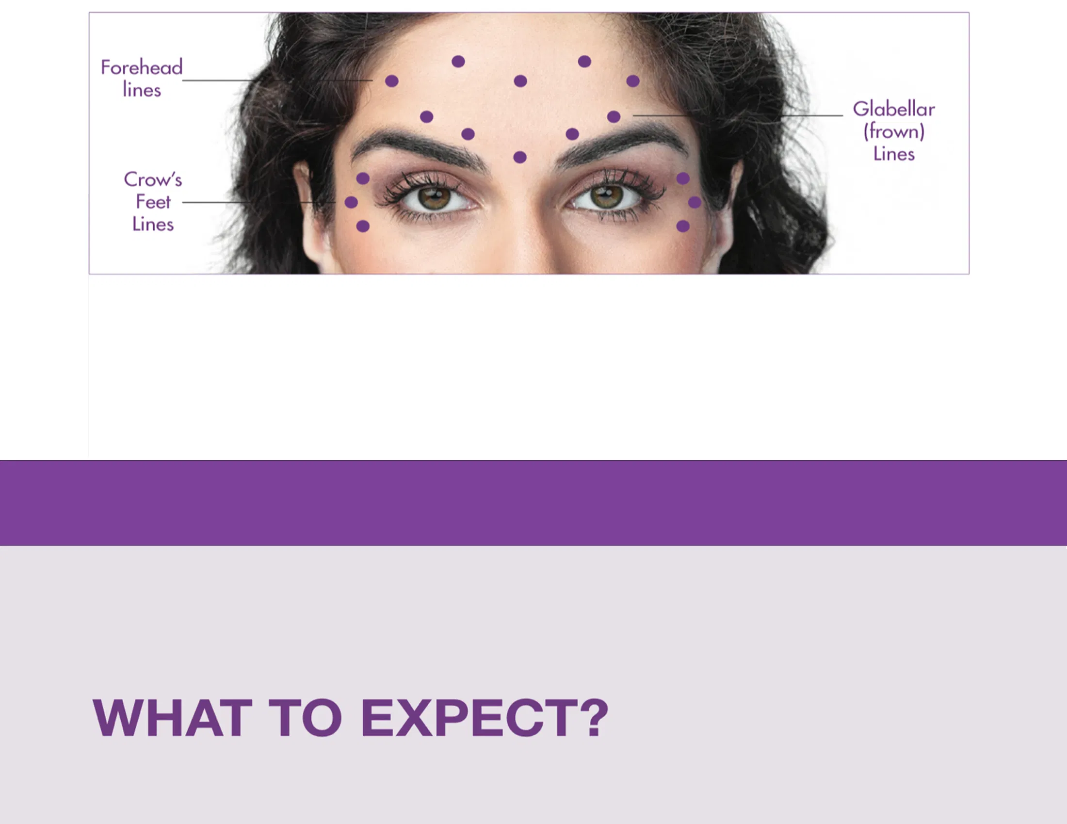 Botox 50 Units · product information