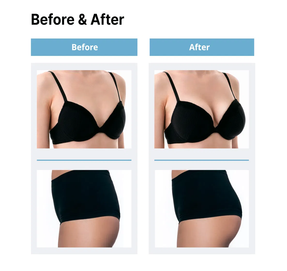 Venu Fill Body Filler Hard Type · product information