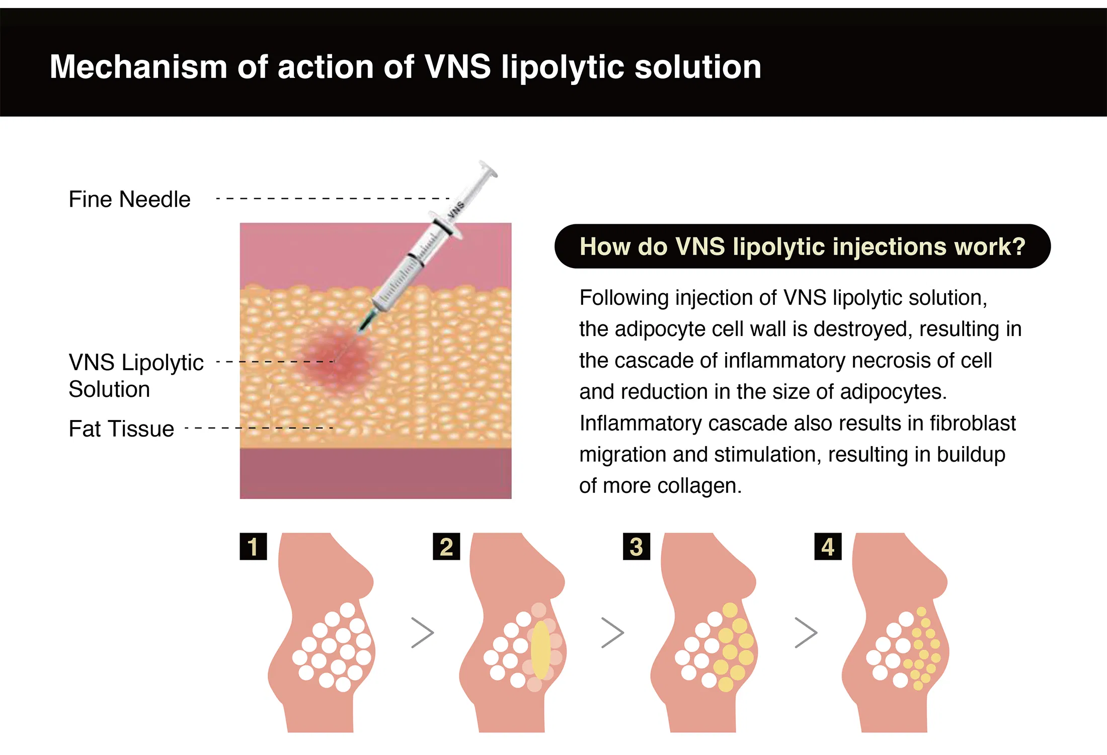 VNS - Lipolytic Solution · product information