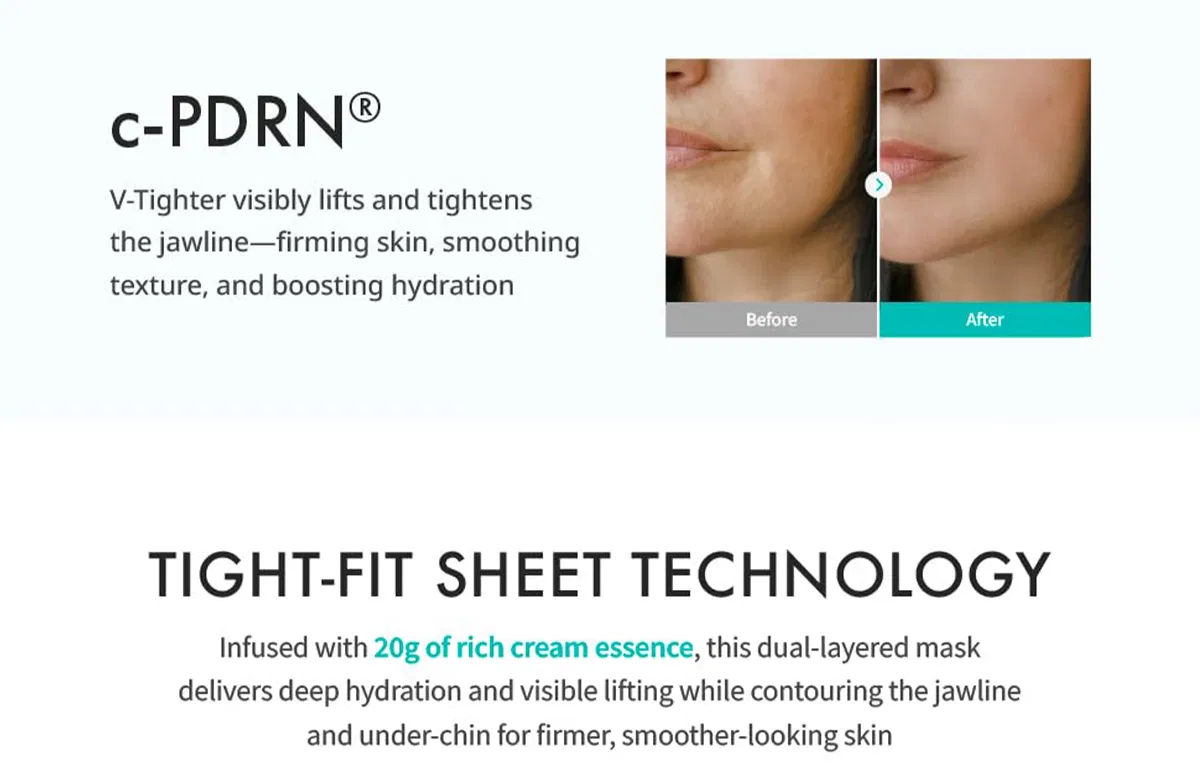 Rejuran Perfect V Tighter · product information