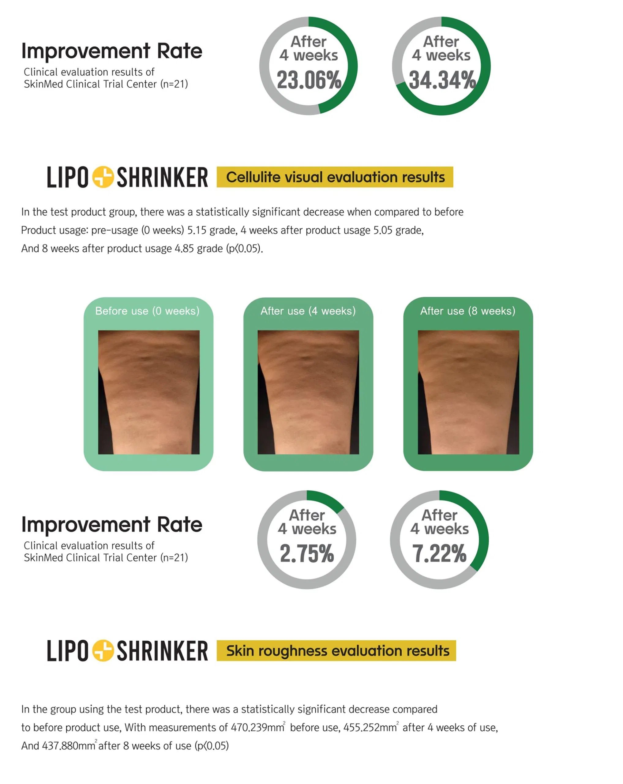 Lipo Shrinker (1 vial) · product information