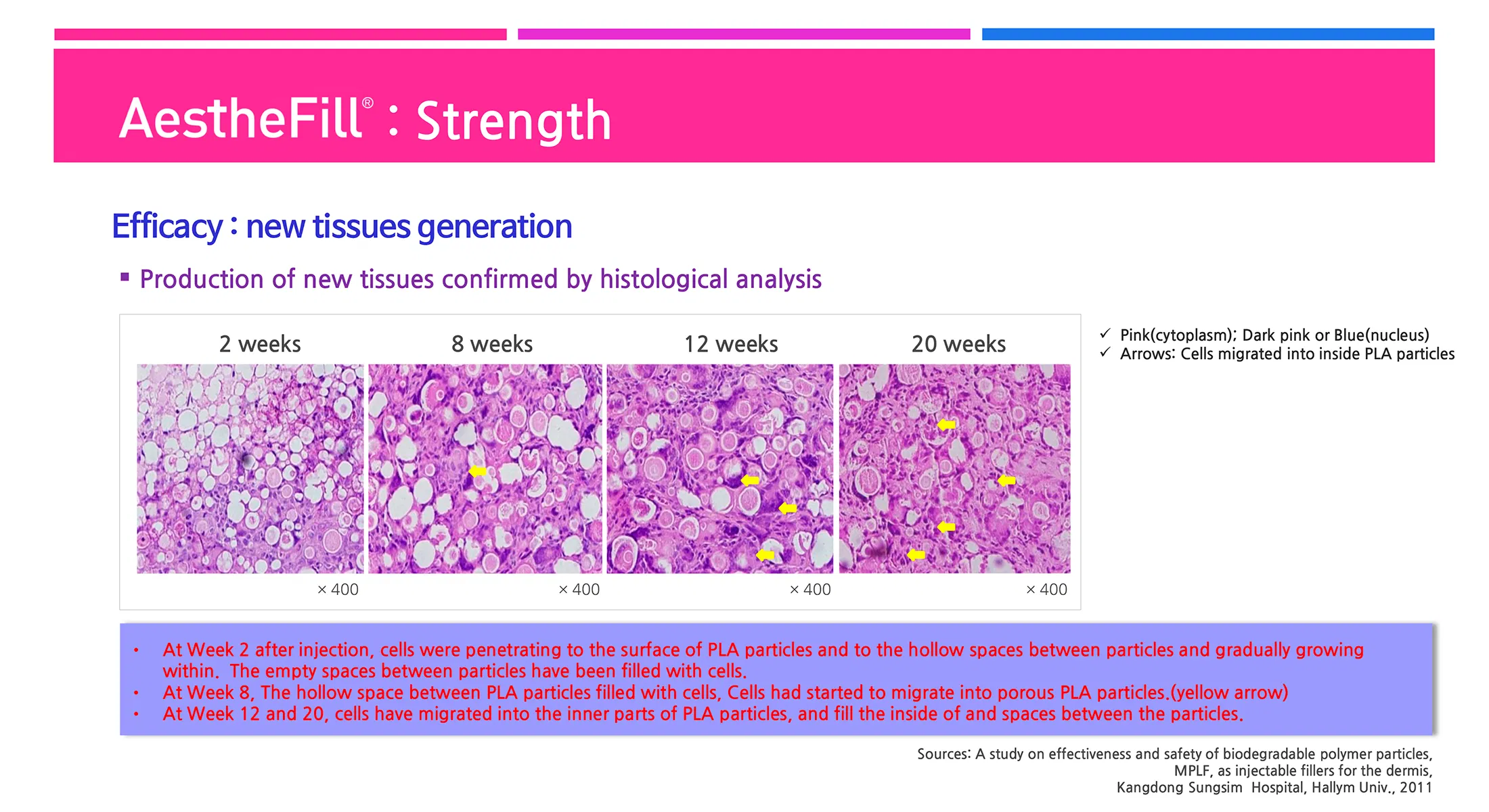 AestheFill · product information