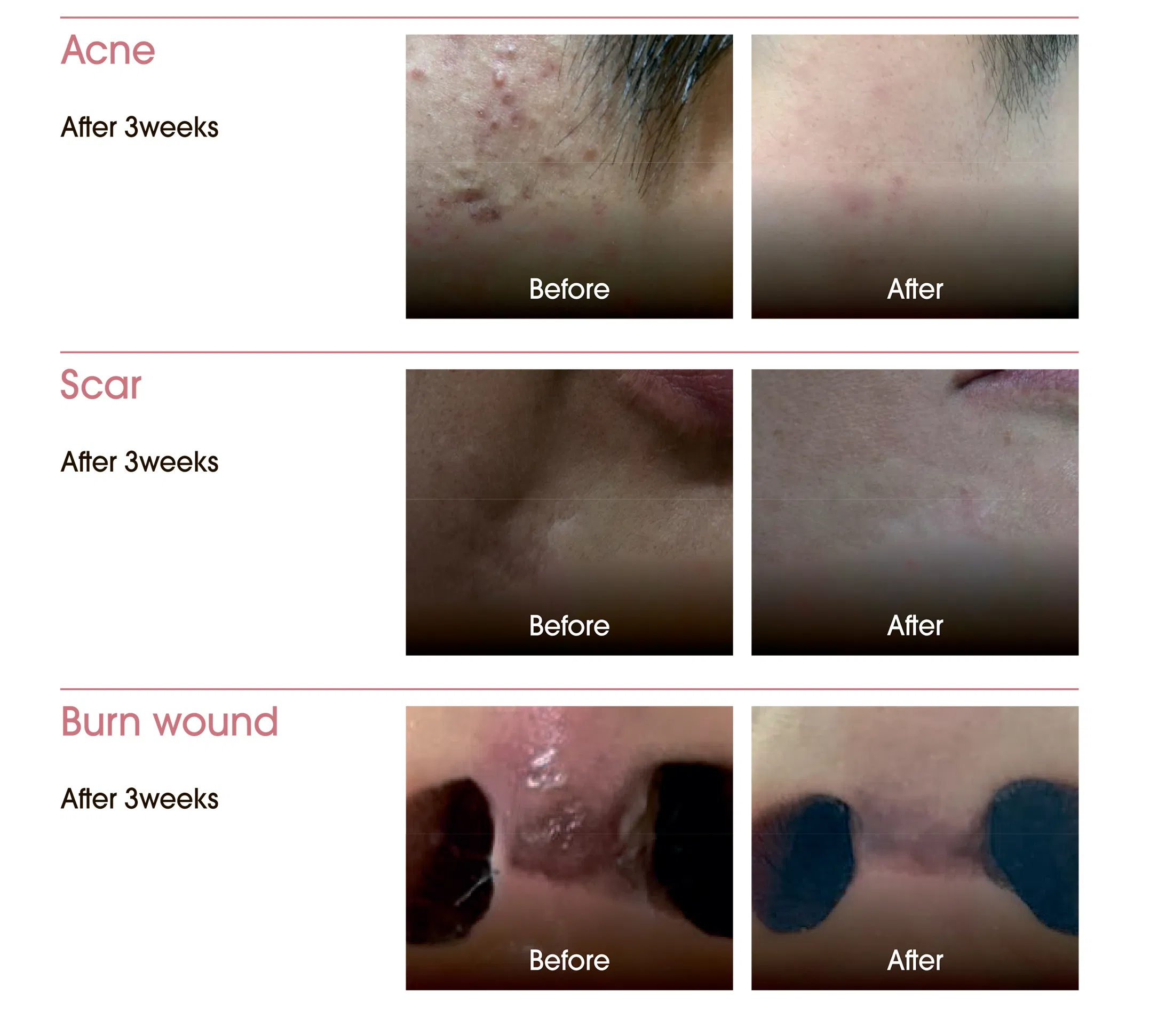 EXOXE · product information