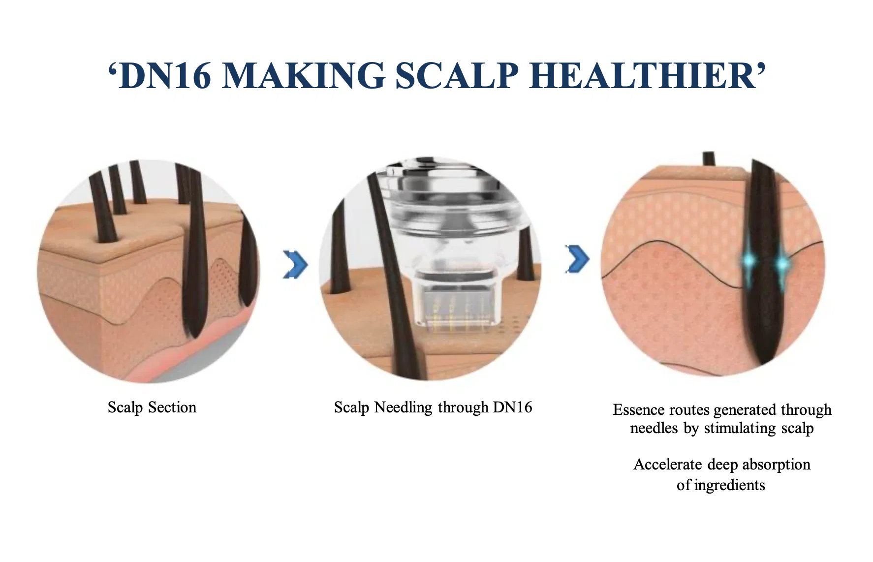 SkinCulture DN16 0.25mm 1pc · product information