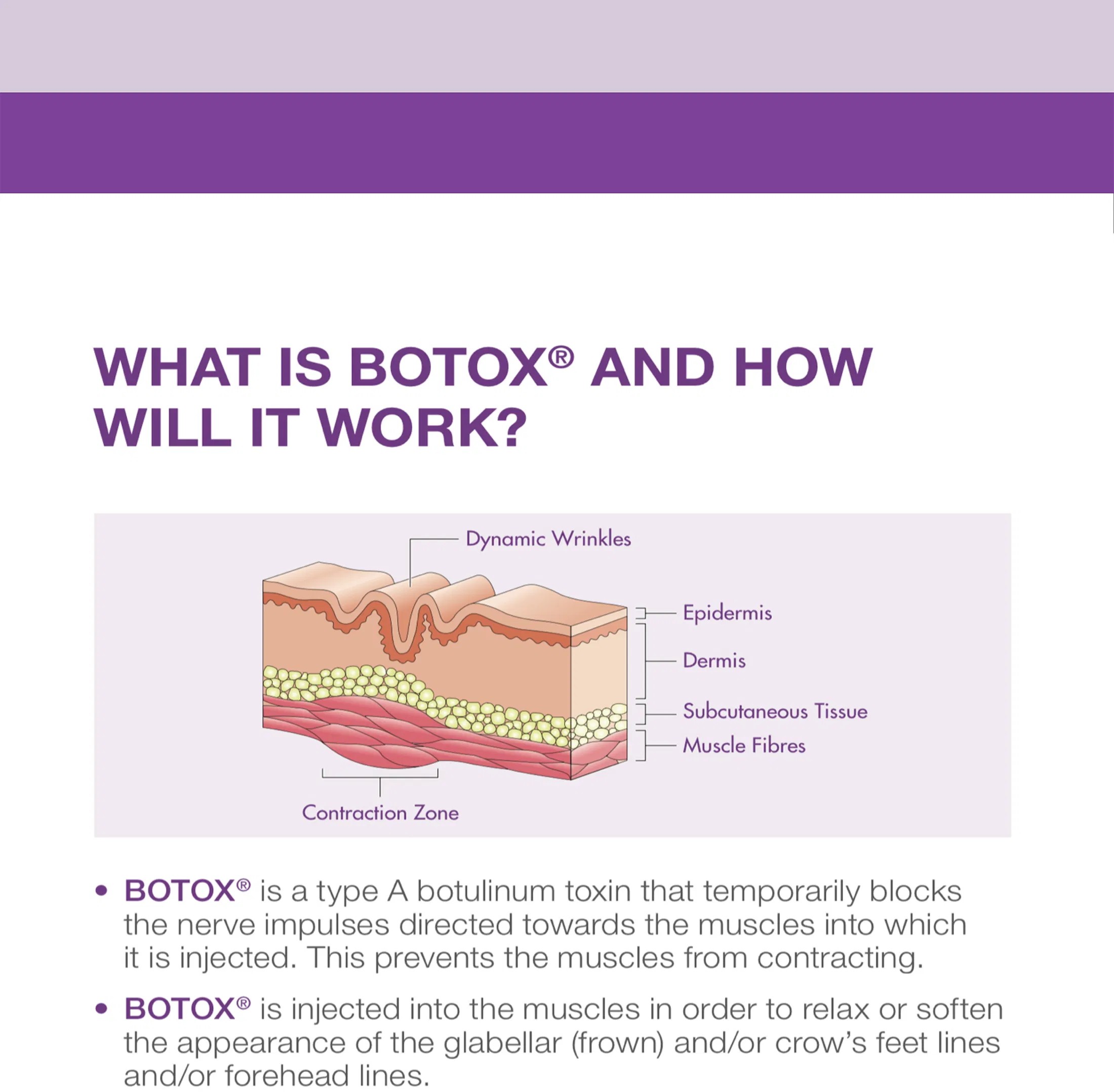 Botox 50 Units · product information