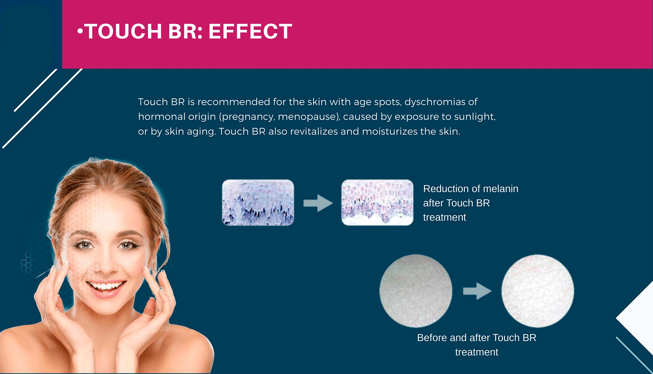 Miracle Touch BR · product information