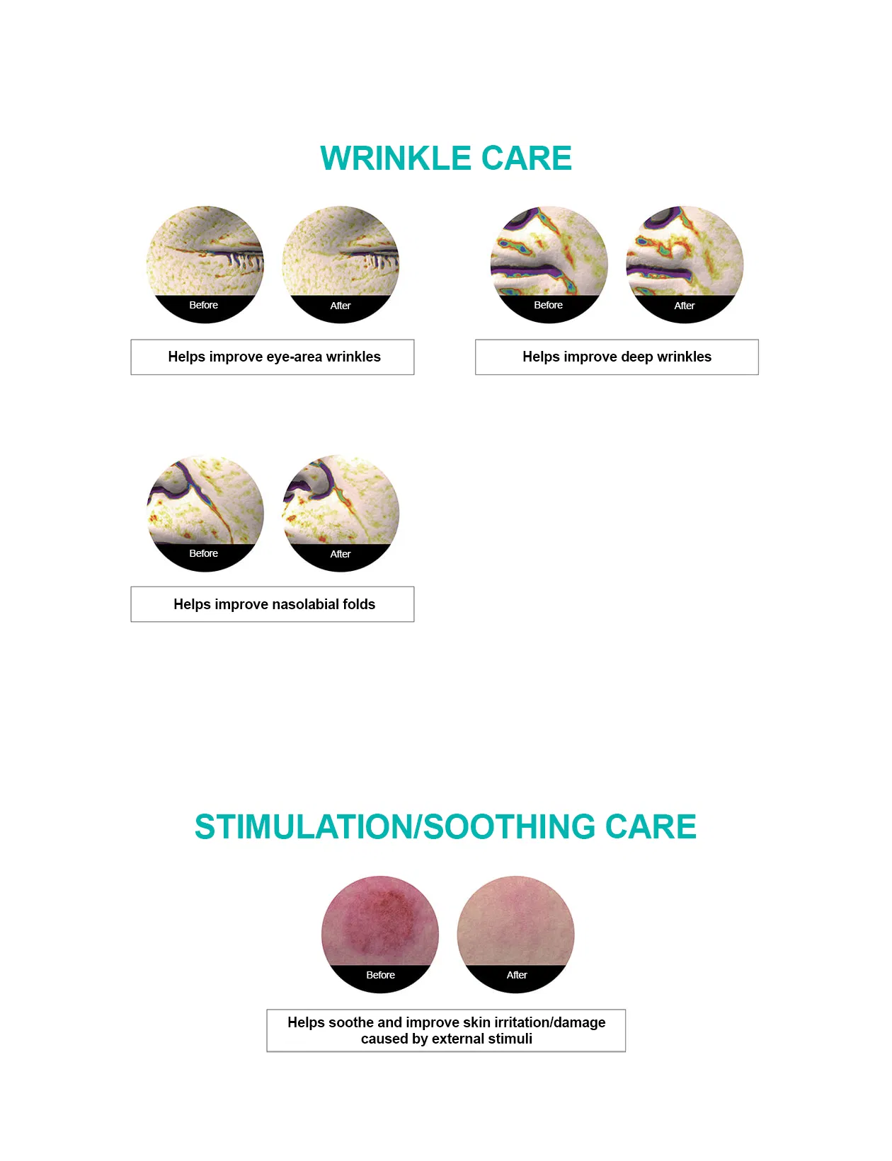 Rejuran Turnover Ampoule · product information