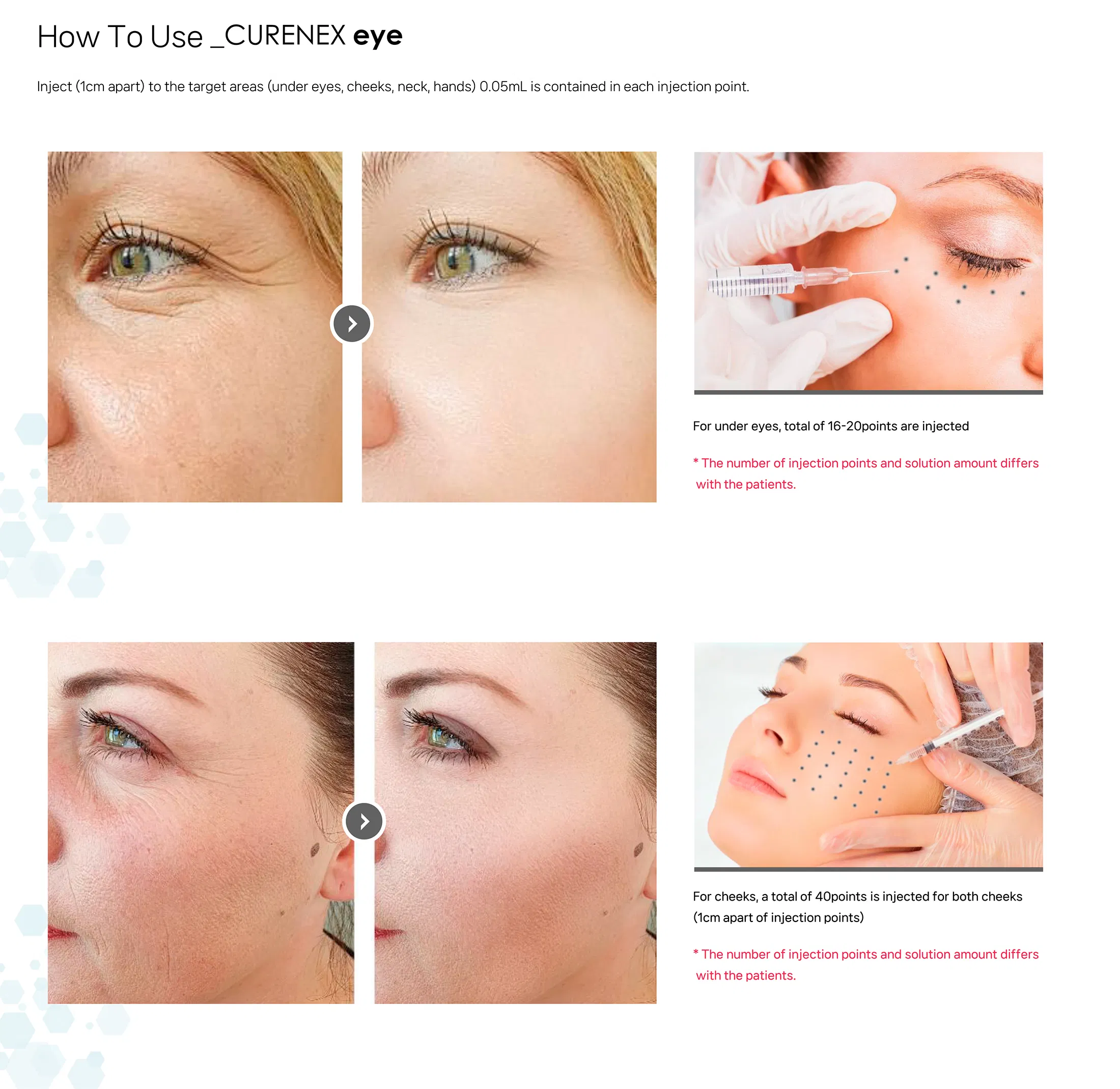 Curenex eye · product information
