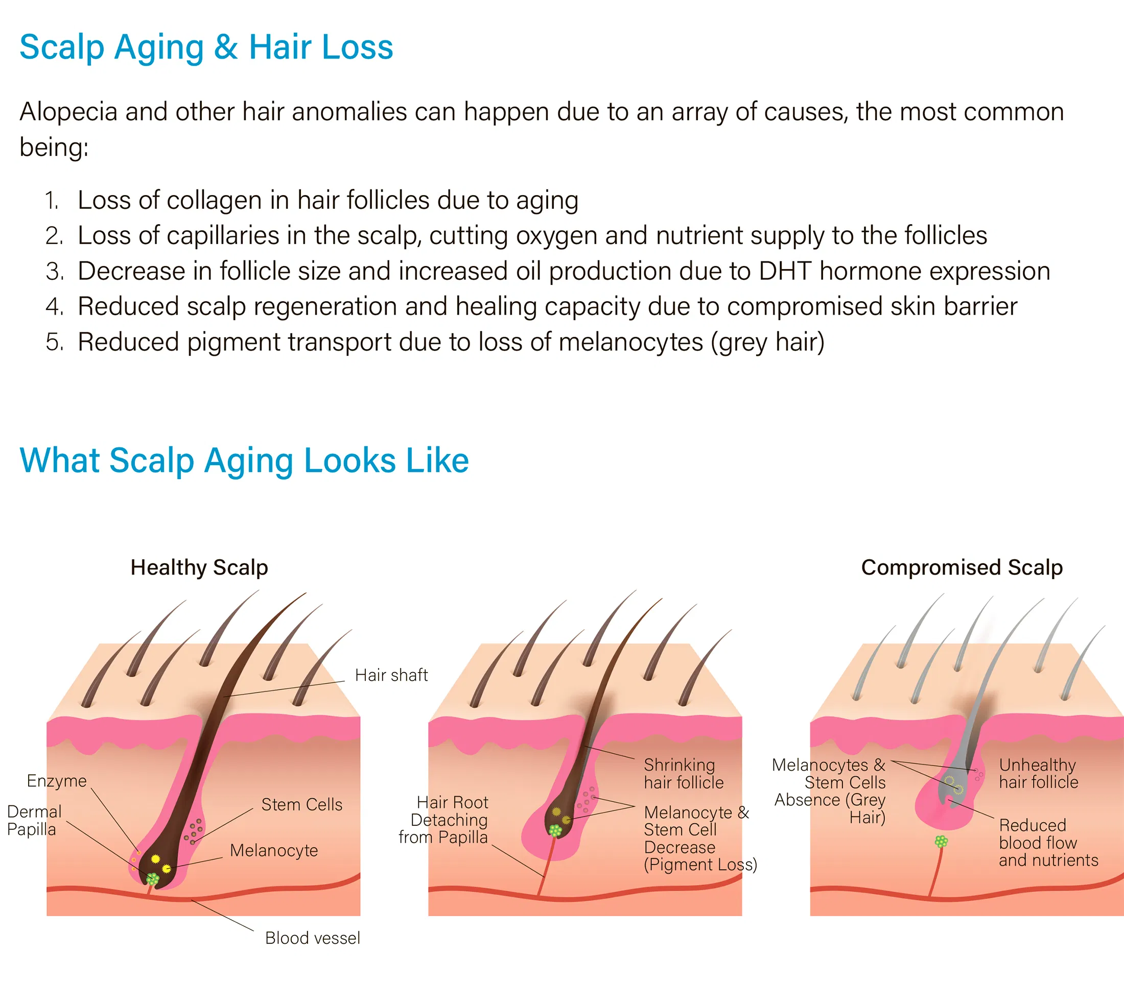 HAIRNA Exosome Hair Fill · product information