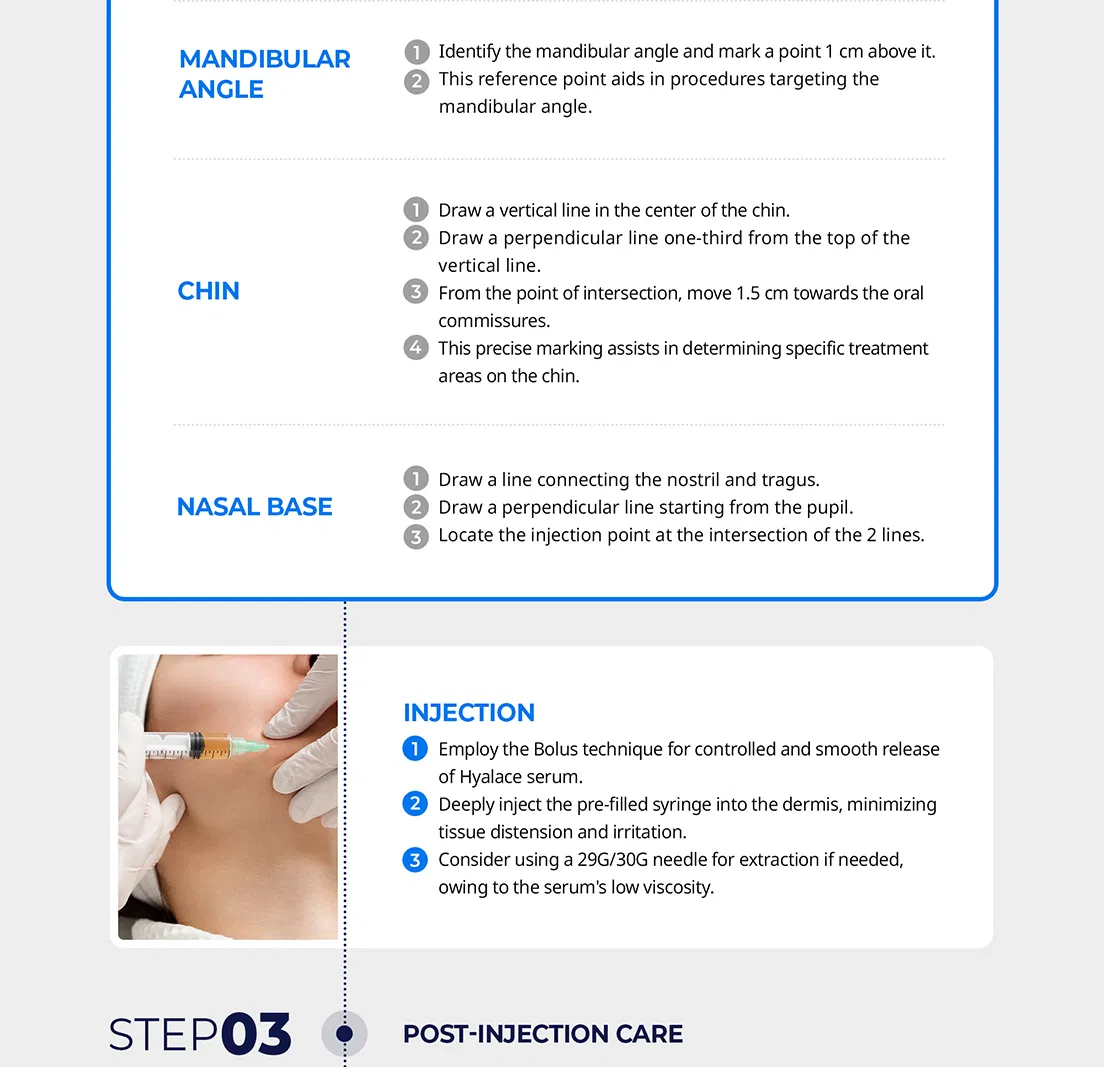 Hyalace · product information