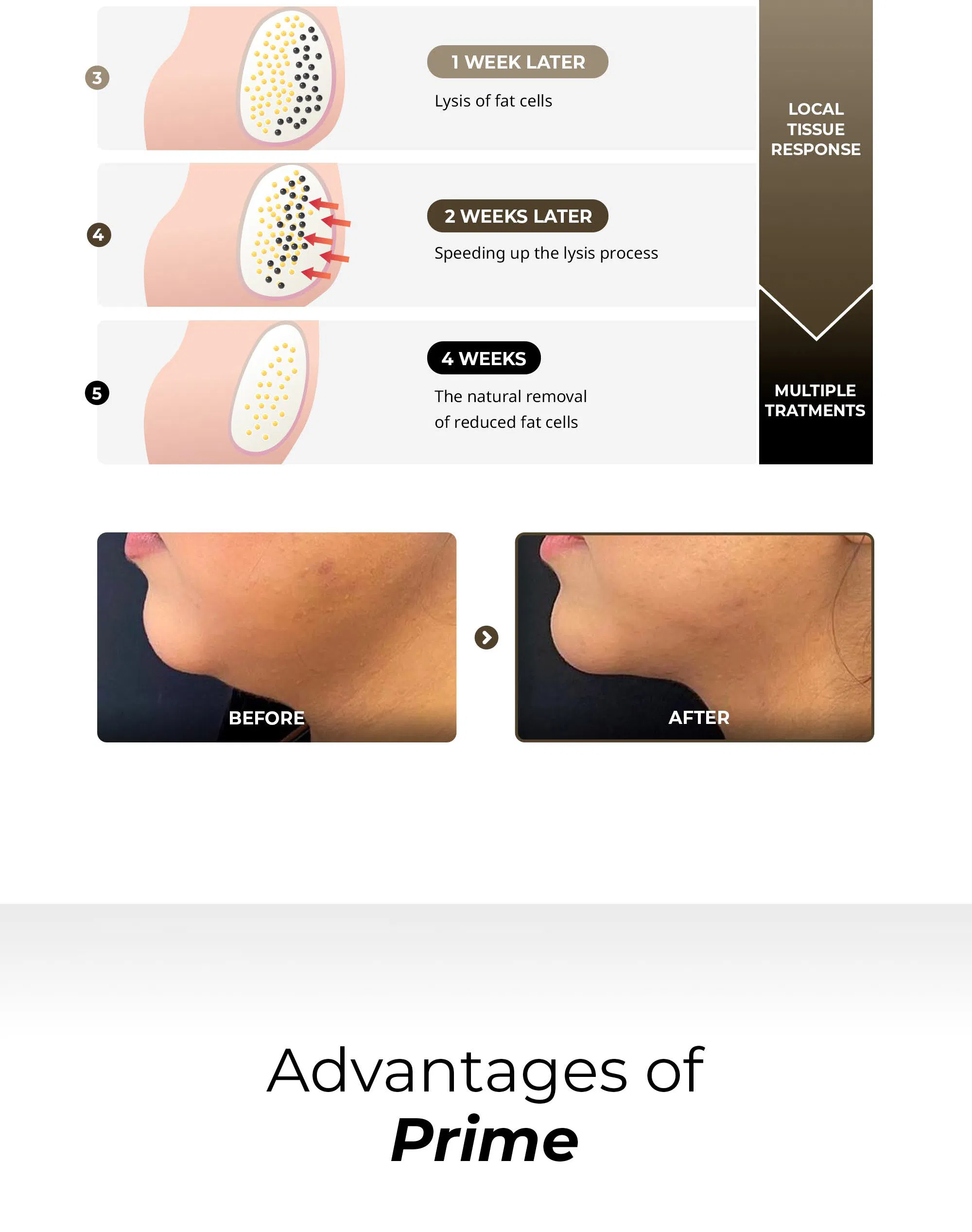 Prime Dr.Lipo+ · product information