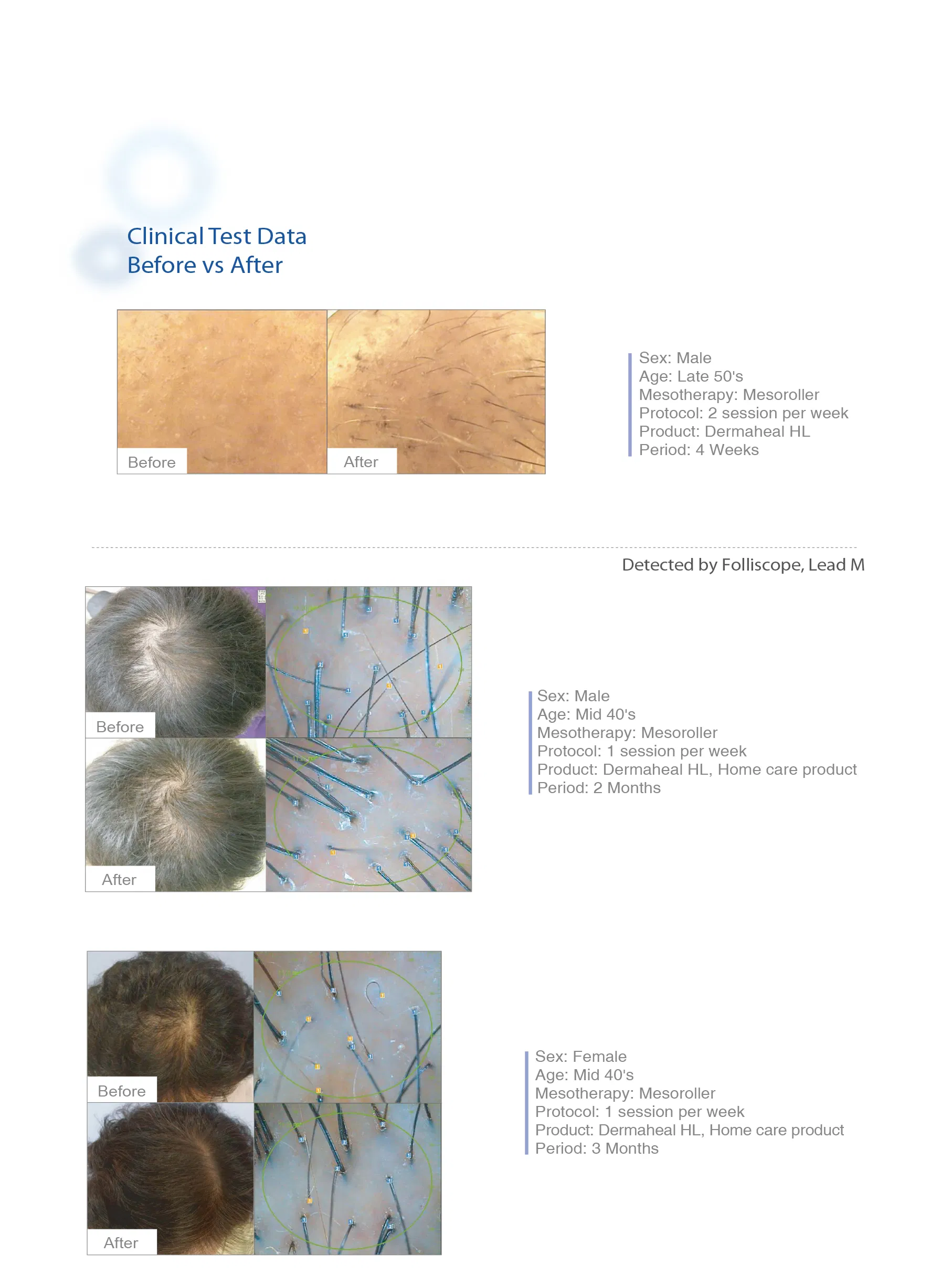 Dermaheal HL · product information