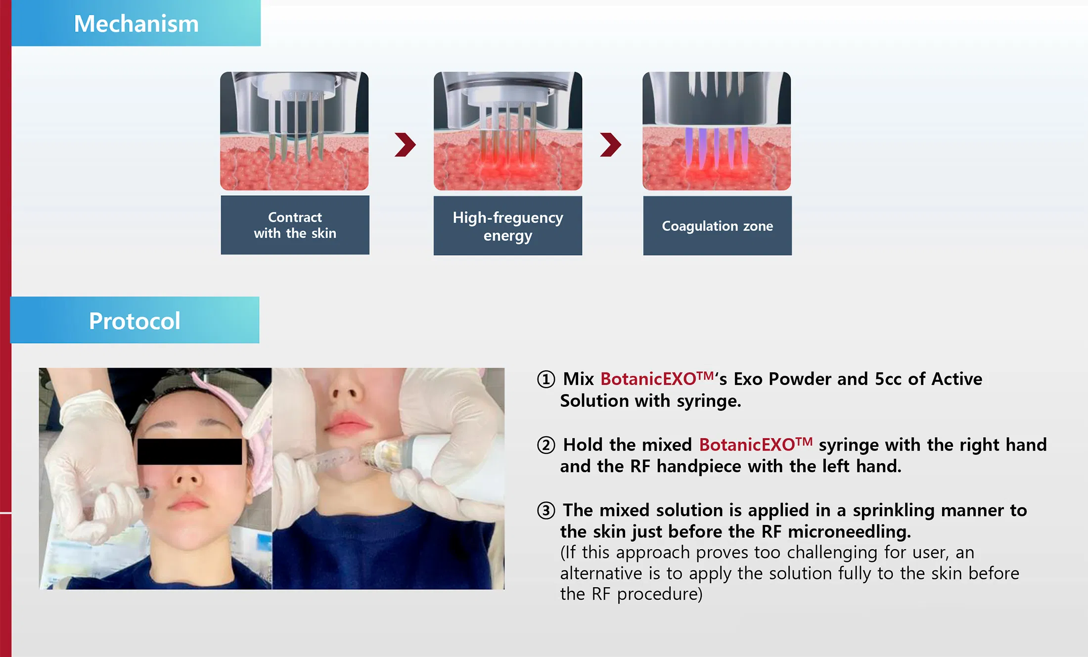 Botanic EXO · product information