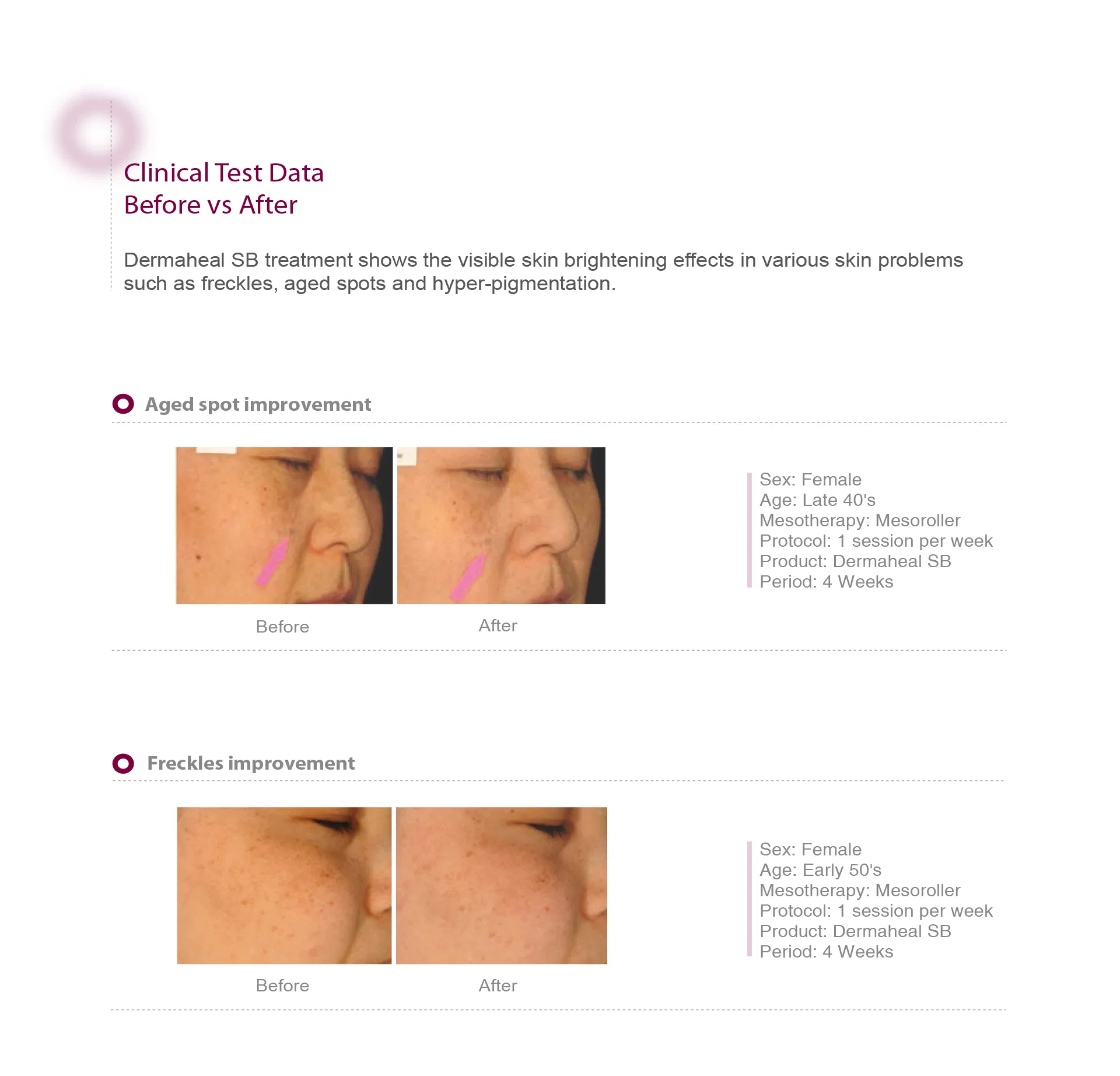 Dermaheal SB · product information