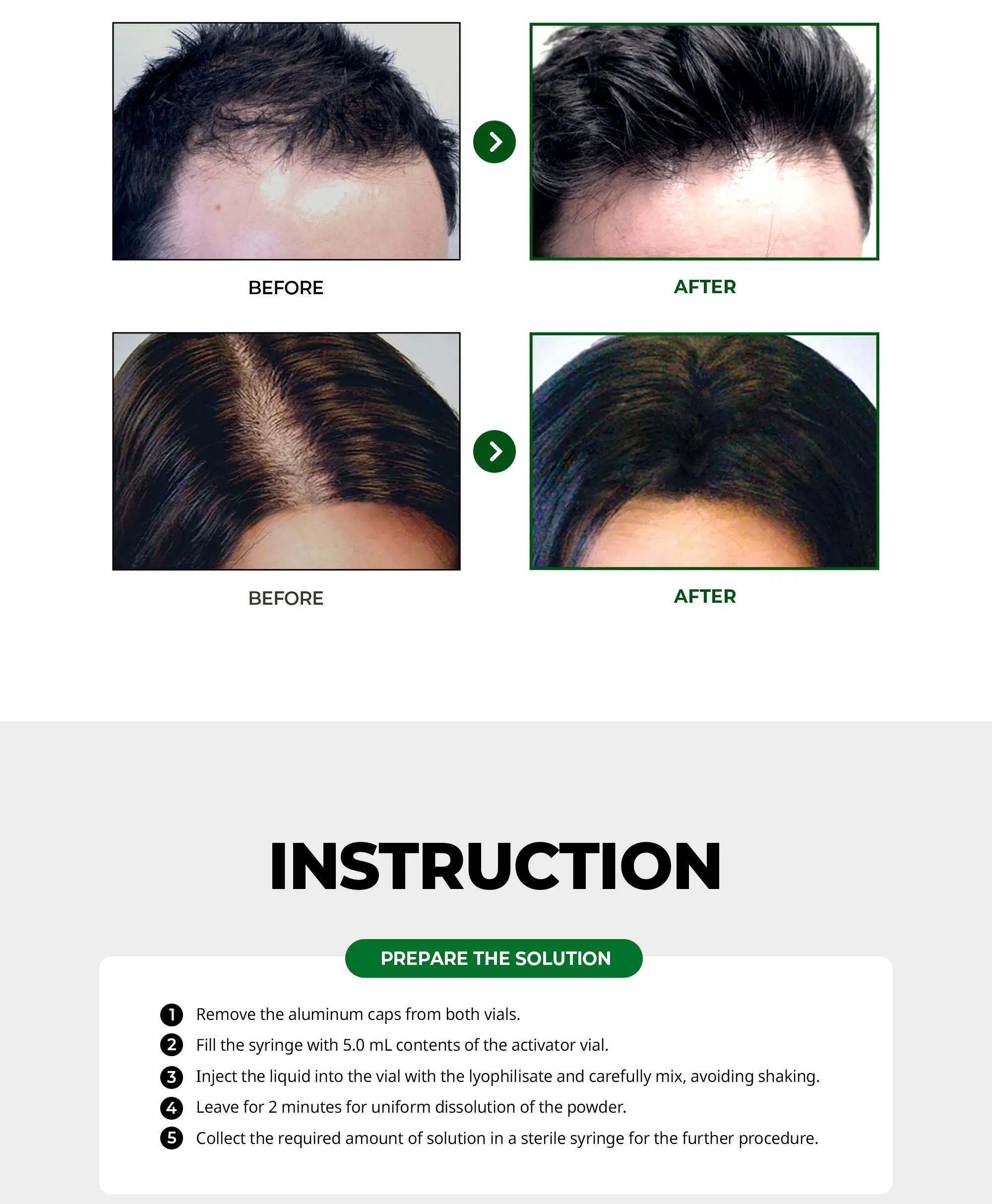 Hanheal Exosome Hair Filler · product information